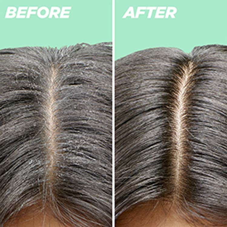 pureclean_hairreset_PBP_scrub_carrousel_238x173_4